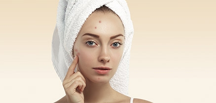 A acne é uma doença de pele busque o dermatologista